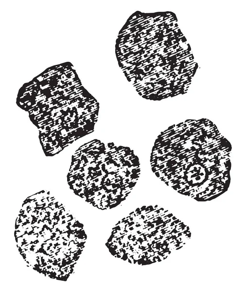 Degeneração granular (inchaço turvo) das células hepáticas, vintage e —  Vetores de Stock