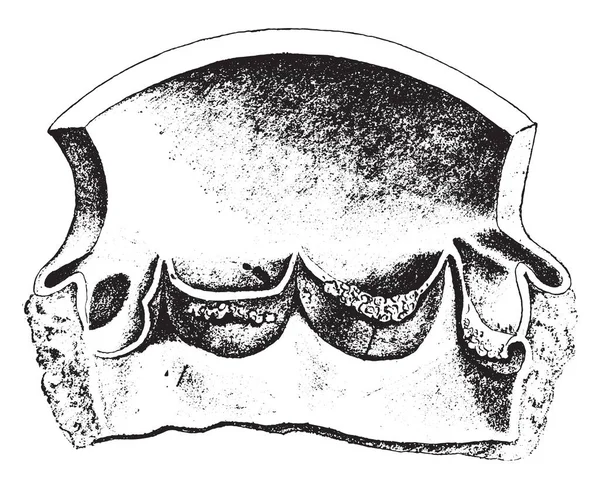Aortenöffnung offen gelegt, zeigt die Klappenblättchen, akutes Endo — Stockvektor