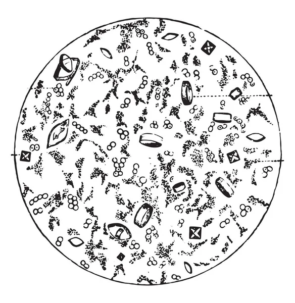 尿の酸発酵におけるいくつかの堆積物 ヴィンテージ刻まれた図 — ストックベクタ