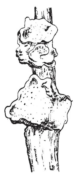 Einheit Von Fruchtbarem Polyporus Annosus Auf Einem Wurzelfragment Gravierte Illustration — Stockvektor