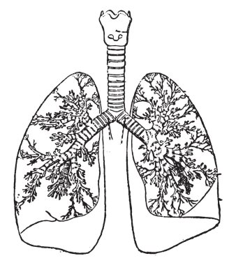 Bronşlar, vintage oyma.
