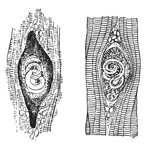 Trichina Spiralis Illustration Mit Vintage Gravur — Stockvektor