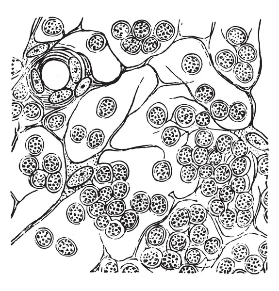 円形細胞肉腫 リンパ ヴィンテージ刻まれた図 — ストックベクタ