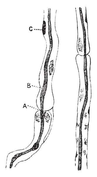 Illustration Represents Nerve Fibers Sciatic Nerve Vintage Line Drawing Engraving — Stock Vector