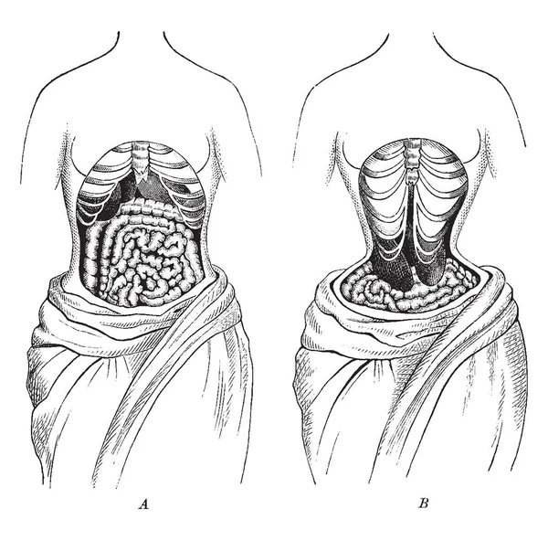这张图代表的自然位置相比 内部器官的变形位置 复古线绘制或雕刻插图 — 图库矢量图片