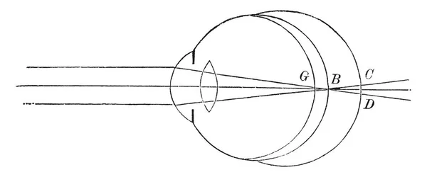 Esta Ilustración Representa Posición Retina Vista Cercana Lejana Dibujo Líneas — Vector de stock