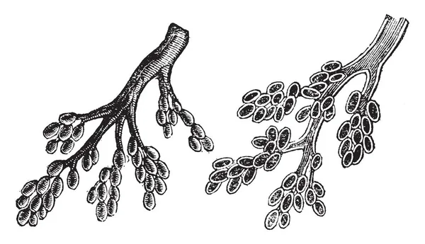 Cette Illustration Représente Des Tubes Bronchiques Terminant Par Des Vésicules — Image vectorielle