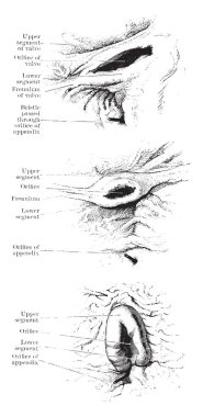 Bu diyagram Ileocecal caecal Vana, vintage çizgi çizme veya oyma illüstrasyon temsil eder..