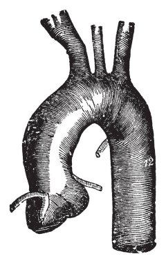 Bu diyagram torasik aortada temsil eder ve üç soldan sağa isimsiz olanlar, vintage çizgi çizme veya oyma illüstrasyon dallar.