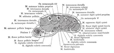Bu resimde kesit aracılığıyla orta metakarpal kemik el, vintage çizgi çizme veya oyma illüstrasyon temsil eder..