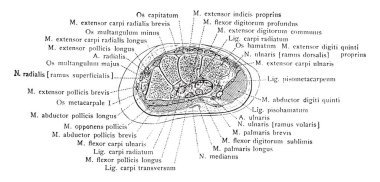Bu resimde bilek ortak aracılığıyla kesit ve karpal kemiklerin, vintage çizgi çizme veya oyma illüstrasyon temsil eder.