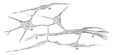 Bu resimde doku büyüme rahim, vintage çizgi çizme veya oyma illüstrasyon temsil eder..