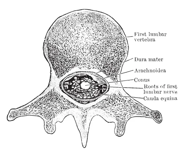 Afdeling Door Middel Van Conus Medullaris Cauda Equina Zoals Het — Stockvector