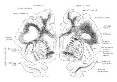 Bu resim serebral hemisferlerin, vintage çizgi çizme veya oyma illüstrasyon koronal bölümlerini temsil eder..