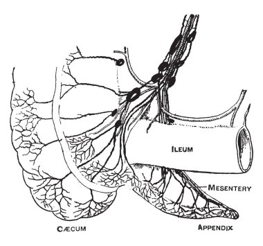 This diagram represents lymphatics of the caecum and appendix, vintage line drawing or engraving illustration. clipart