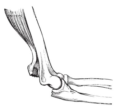 Bu resimde kırık Olecranon, vintage çizgi çizme veya oyma illüstrasyon temsil eder..
