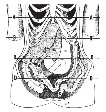 Visceroptosis, vintage çizgi çizme veya oyma illüstrasyon durumda iç organlar konumunu gösteren.