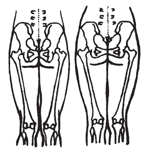 Questa Illustrazione Rappresenta Posizione Delle Ossa Pelviche Delle Cosce Nell — Vettoriale Stock