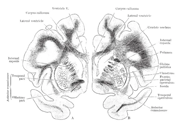 Bu resim serebral hemisferlerin, vintage çizgi çizme veya oyma illüstrasyon koronal bölümlerini temsil eder..