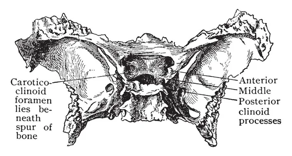 Bu resimde anormal ense kemik, vintage çizgi çizme veya oyma illüstrasyon temsil eder..