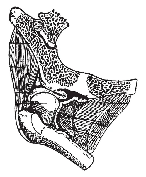 この図は 先天性脱臼股関節 ビンテージの線描画や彫刻イラスト — ストックベクタ