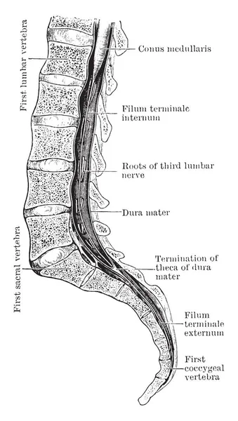 Cono Medular Filum Terminale Expuestos Dentro Del Canal Espinal Trazado — Archivo Imágenes Vectoriales