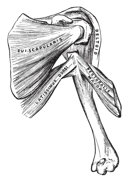 Esta Ilustración Representa Humerus Fracturado Dibujo Línea Vintage Ilustración Grabado — Archivo Imágenes Vectoriales