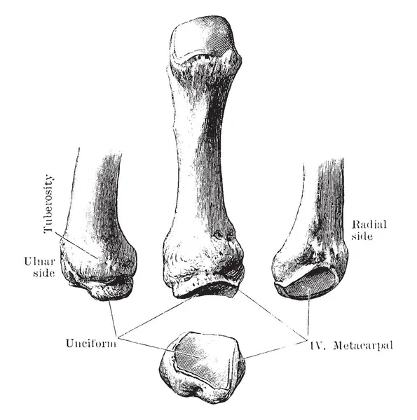 Bu resimde beşinci metakarpal kemik, vintage çizgi çizme veya oyma illüstrasyon temsil eder..