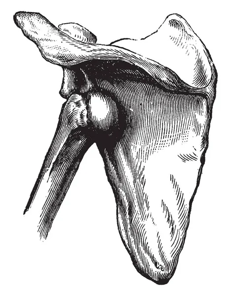 Cette Illustration Représente Une Luxation Subspineuse Humérus Dessin Ligne Vintage — Image vectorielle