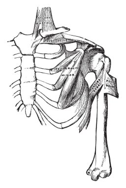 Bu resimde kırık Clavical, vintage çizgi çizme veya oyma illüstrasyon temsil eder..