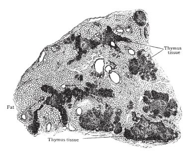 Bu resimde timus doku, gösterilen değiştirme timus çizim veya illüstrasyon oyma şişman, vintage satırı ile temsil eder.