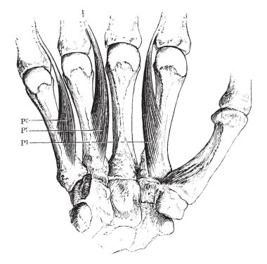 Bu örnekte el, vintage çizgi çizme veya oyma illüstrasyon Palmar interosseöz kaslarının temsil eder..