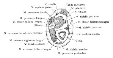 Bu resimde kesit dört inç yukarıda alt sonu Fibula, vintage çizgi çizme veya oyma illüstrasyon temsil eder..
