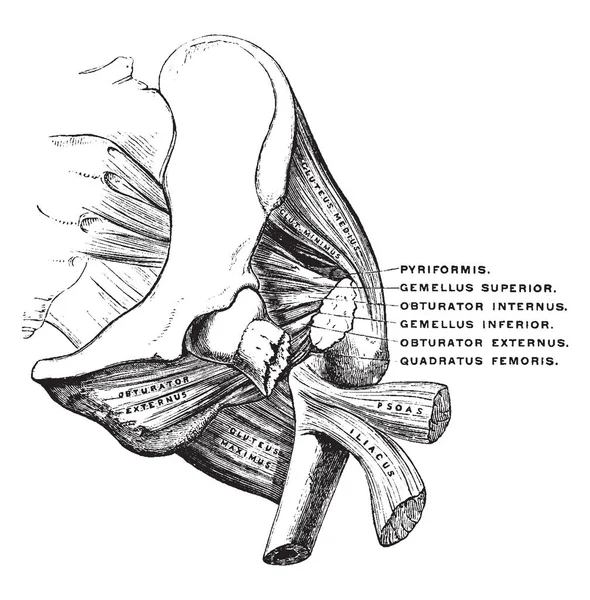 Fratura Pescoço Fémur Dentro Ligamento Capsular Desenho Linha Vintage Gravura — Vetor de Stock