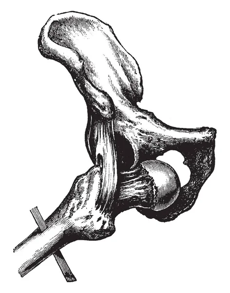 この図は甲状腺脱臼股関節 ビンテージの線描画や彫刻イラストを表します — ストックベクタ