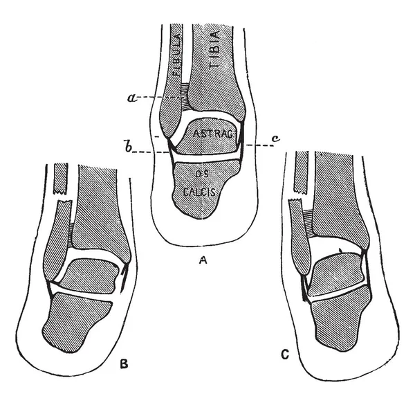 Иллюстрация Представляет Собой Поперечное Сечение Через Нижнюю Ногу Рисунок Винтажной — стоковый вектор