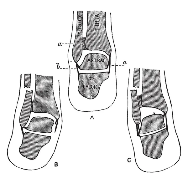 Deze Afbeelding Vertegenwoordigt Transversale Gedeelte Het Onderbeen Vintage Lijntekening Gravure — Stockvector