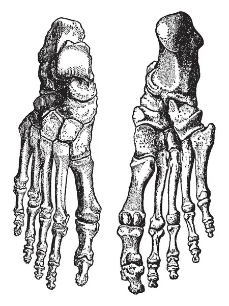 这个插图代表脚的骨骼 复古线画或雕刻插图 — 图库矢量图片