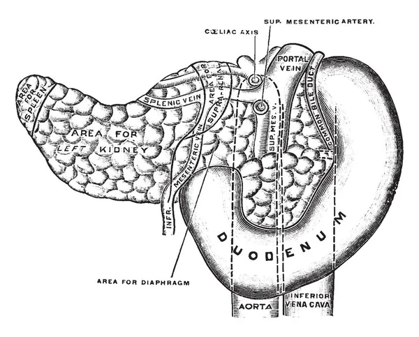 Questo Diagramma Rappresenta Pancreas Duodeno Disegno Linee Vintage Illustrazione Incisione — Vettoriale Stock