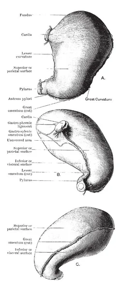 Cette Illustration Représente Distended Stomach Dessin Ligne Vintage Illustration Gravure — Image vectorielle