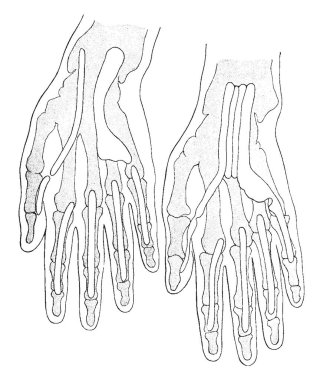 Fleksör tendon kılıfı, vintage çizgi çizme veya oyma resimde iki tür projeksiyonlar.