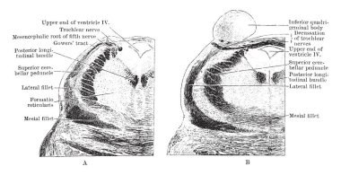 İki bölümden pons onun üst kısmında tegmentum aracılığıyla mesencephalon, vintage çizgi çizme veya oyma illüstrasyon kapatmak.