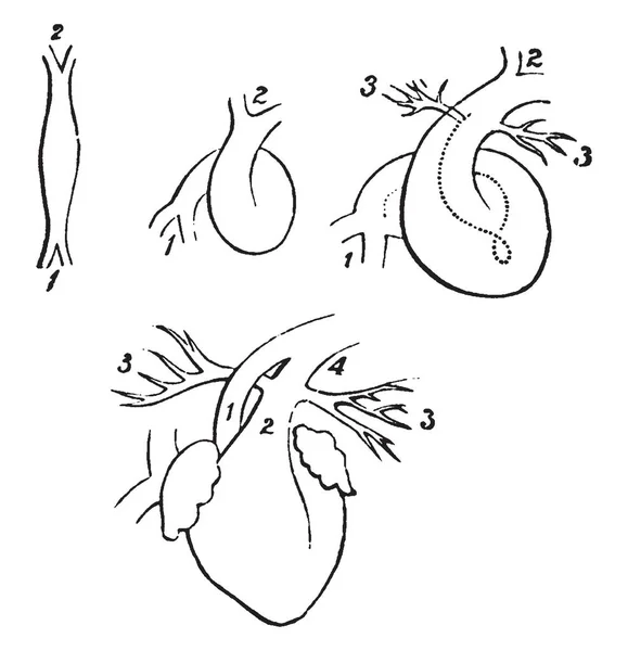 Esta Ilustração Representa Coração Fetal Fases Sucessivas Desenvolvimento Desenho Linha —  Vetores de Stock