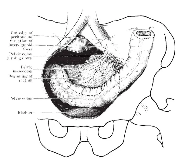 Este Diagrama Representa Los Colones Ilíacos Pélvicos Dibujo Líneas Vintage — Archivo Imágenes Vectoriales