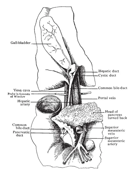 Dit Diagram Vertegenwoordigt Het Gedeelte Van Gal Toestellen Vintage Lijntekening — Stockvector