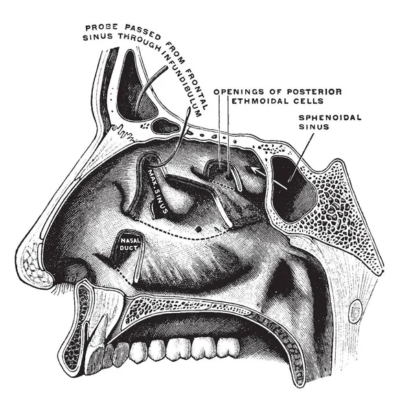 Questa Illustrazione Rappresenta Parete Esterna Della Cavità Nasale Disegno Linee — Vettoriale Stock