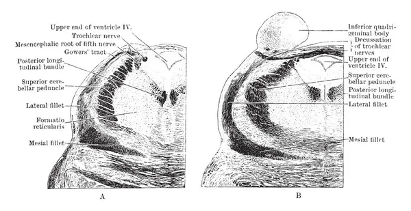 İki bölümden pons onun üst kısmında tegmentum aracılığıyla mesencephalon, vintage çizgi çizme veya oyma illüstrasyon kapatmak.