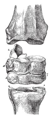 Carpus bir at en üstte yer alan kemik distal radius, vintage çizgi çizme veya oyma illüstrasyon bitti.