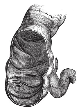 Bu diyagram ileocecal Vana, vintage çizgi çizme veya oyma resimde gösterilen çekum temsil eder..