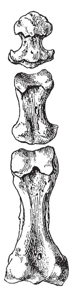 Esta Ilustración Representa Falanges Del Segundo Dedo Del Pie Dibujo — Archivo Imágenes Vectoriales